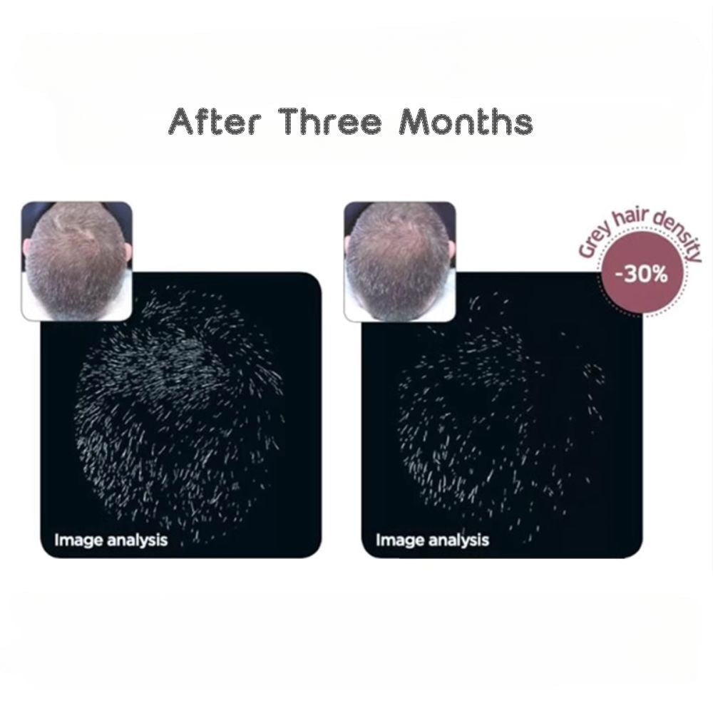 ISOMERS Skincare Grey Gone Hair & Scalp Serum Duo 55ML