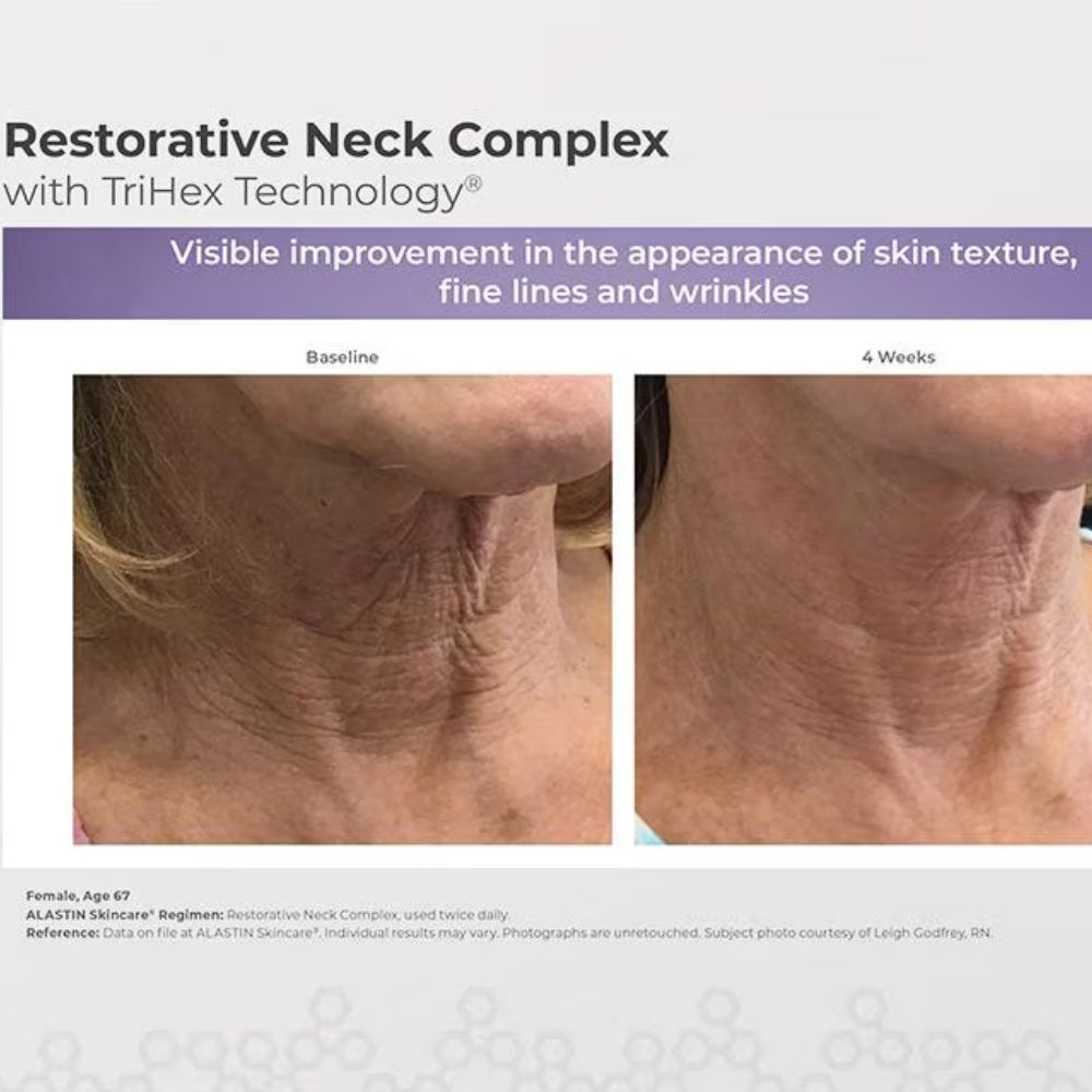 Alastin Restorative Neck Complex with TriHex Technology® 50ml